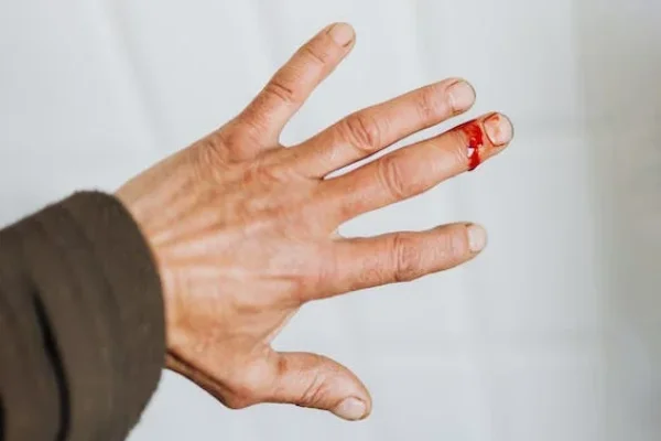 Entredesa_seguridadindutrial_proteccioncivil_seguridad_manos_NOM-017-STPS